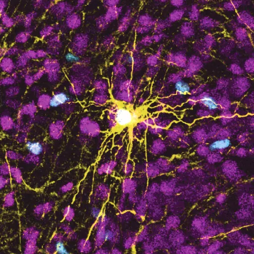 This microscope image provided by Pasca Lab/Stanford Medicine shows a human astrocyte cell, center in yellow, and human glial cells (scattered in blue) inside the brain of a rat. (Pasca Lab/Stanford Medicine via AP)