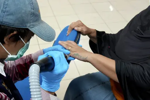 Sri Indrayati, 52, removes the tattoo of the name of her first daughter that she got shortly after she gave birth to her at the age of 22, in Jakarta, Indonesia, Wednesday, March 19, 2025. (AP Photo/Achmad Ibrahim)