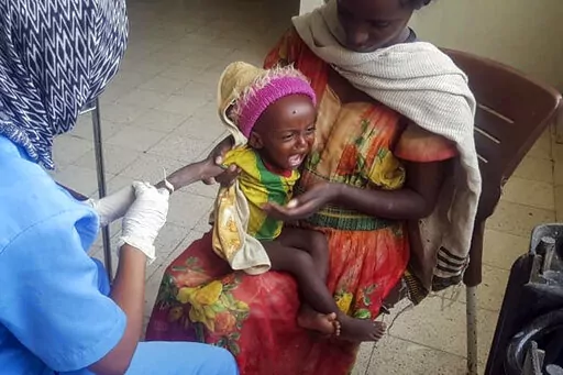 Medhin Gereziher, 1, is treated for malnutrition at the Ayder Referral Hospital in Mekele, in the Tigray region of northern Ethiopia Tuesday, Oct. 4, 2022. Babies are dying in their first month of life at four times the rate they did before the war in Ethiopia's Tigray region, according to a yet-unpublished study shared by its authors with The Associated Press. (AP Photo)